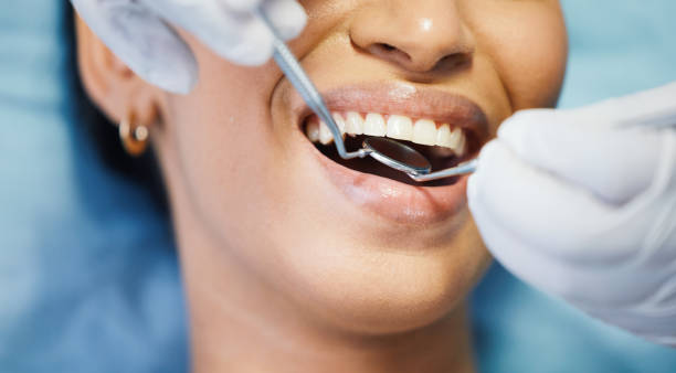Best Emergency Treatment for Toothache in Spindale, NC